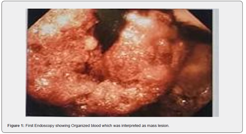 Click here to view Large Figure 1