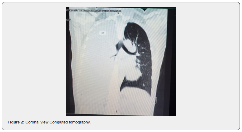 Click here to view Large Figure 2