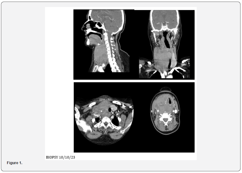 Click here to view Large Figure 1