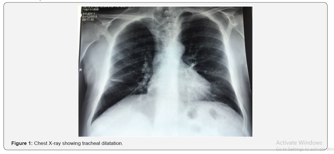 International Journal of Pulmonary & Respiratory Sciences