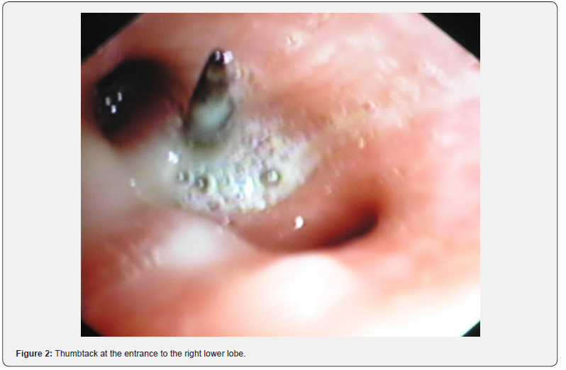 Click here to view Large Figure 2