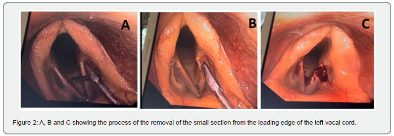 Click here to view Large Figure 2