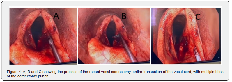 Click here to view Large Figure 4