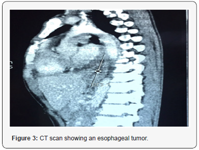 Click here to view Large Figure 3