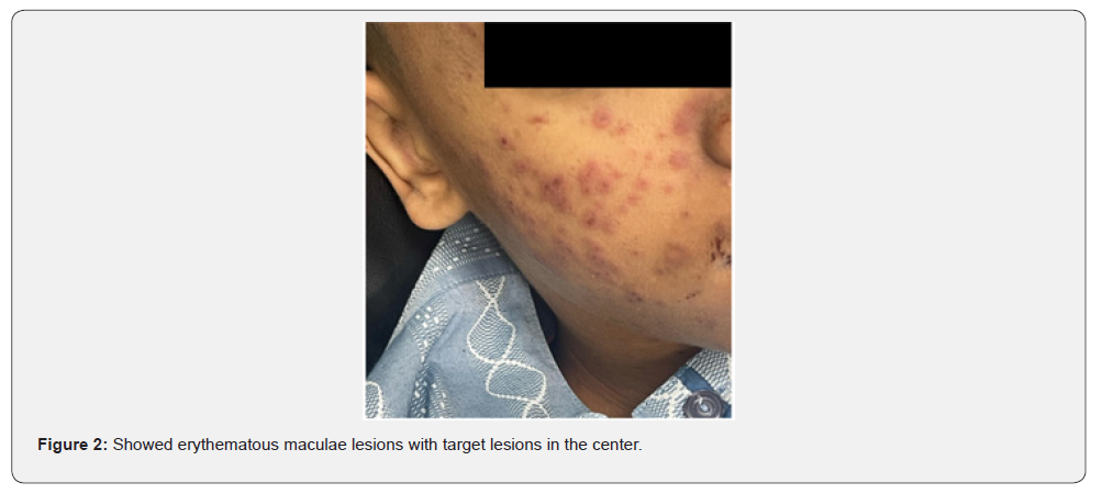 Click here to view Large Figure 2