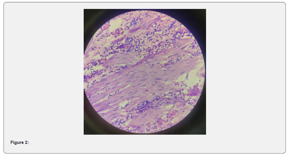 Click here to view Large Figure 2