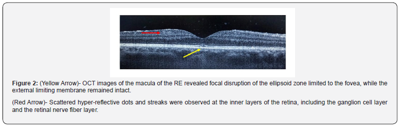Click here to view Large Figure 2