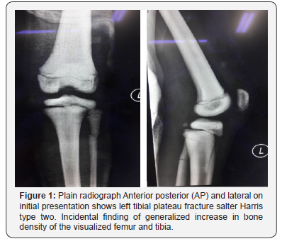 Juniper Online Journal of Orthopedic & Orthoplastic Surgery