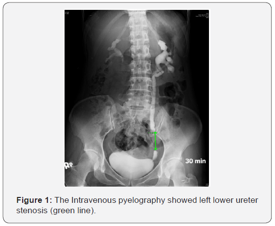 Click here to view Large Figure 1