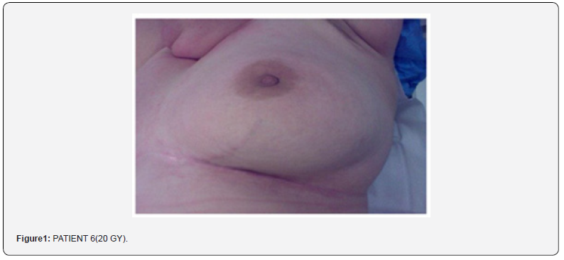 Click here to view Large Figure 1 Journal of Tumor Medicine & Prevention