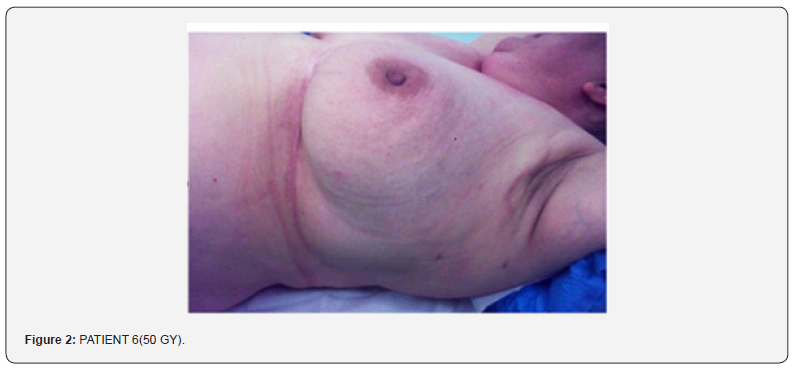 Click here to view Large Figure 2 Journal of Tumor Medicine & Prevention