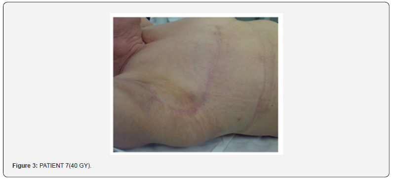 Click here to view Large Figure 3 Journal of Tumor Medicine & Prevention