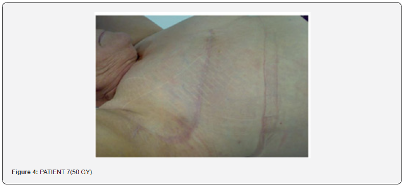 Click here to view Large Figure 4 Journal of Tumor Medicine & Prevention