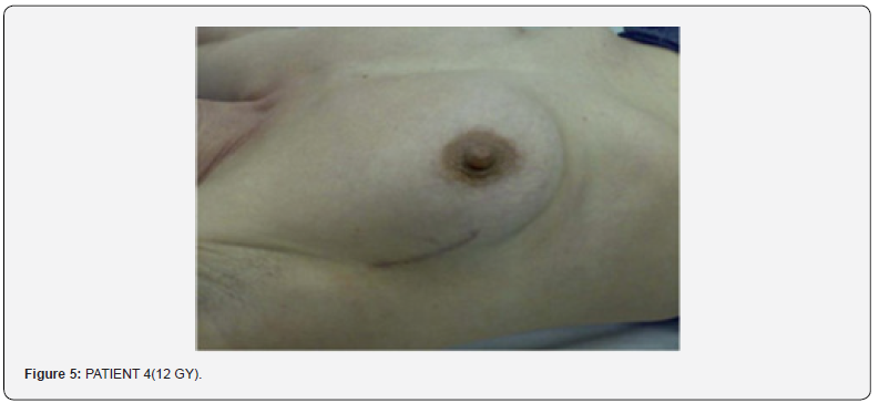Click here to view Large Figure 5 Journal of Tumor Medicine & Prevention