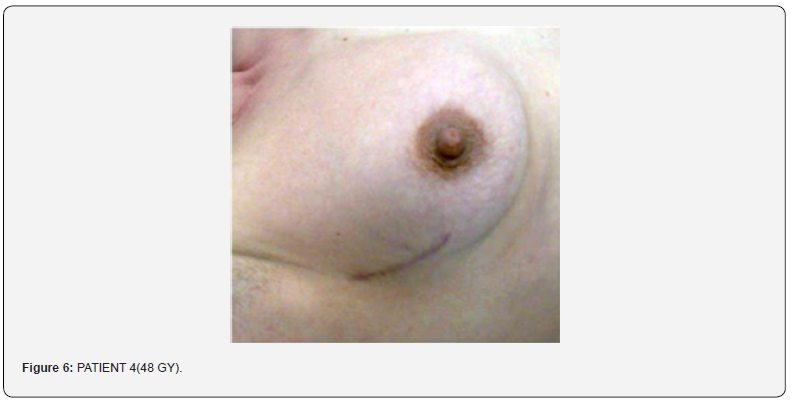 Click here to view Large Figure 6 Journal of Tumor Medicine & Prevention