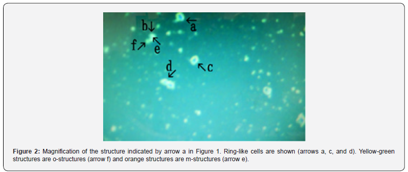 Click here to view Large Figure 2 Journal of Tumor Medicine & Prevention
