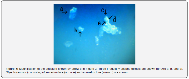 Click here to view Large Figure 5 Journal of Tumor Medicine & Prevention