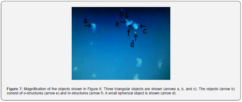 Click here to view Large Figure 7 Journal of Tumor Medicine & Prevention