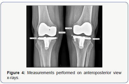Open Access Journal Of Surgery OAJS Juniper Publishers
