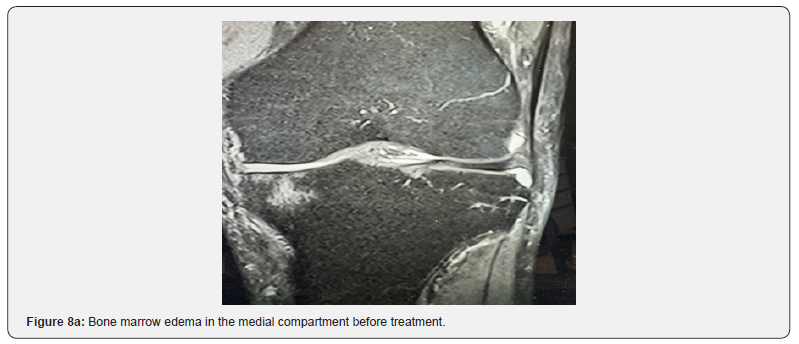 Click here to view Large Figure 8a