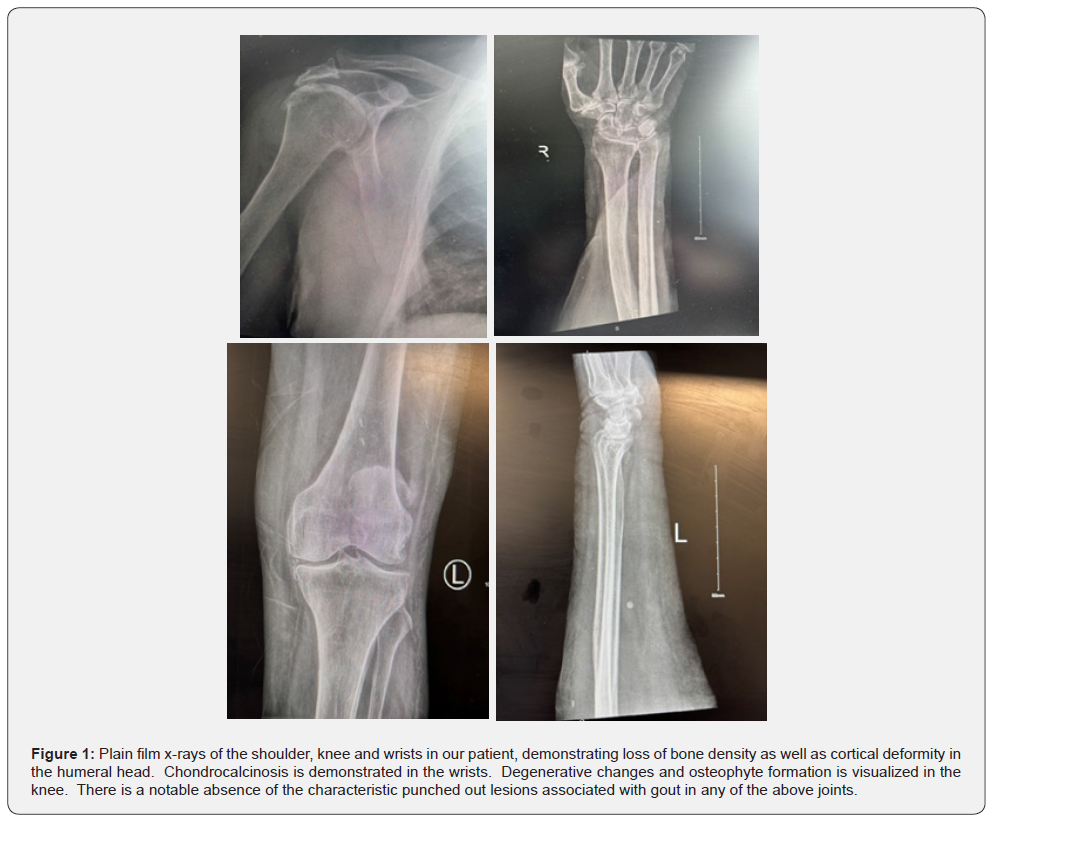 Click here to view Large Figure 1